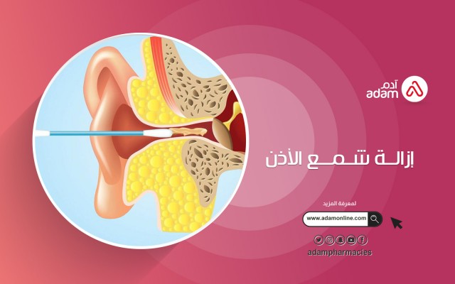 إزالة شمع الأذن